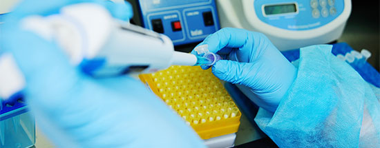 RCPA’s concerns over direct to consumer genetic testing